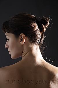 Mind Body Soul - acupuncture needles in woman's neck